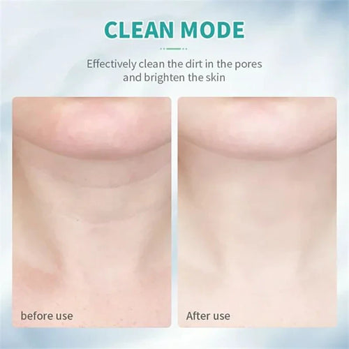 Neck Face Lifting Beauty Device