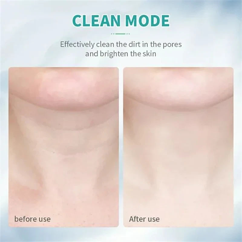 Neck Face Lifting Beauty Device